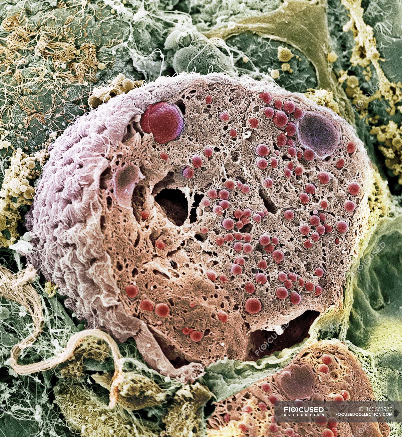 Раковые клетки под микроскопом