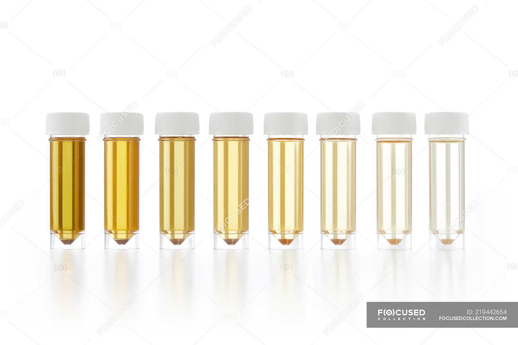 Test Tubes With Urine Samples For Analysis On White Background Studio