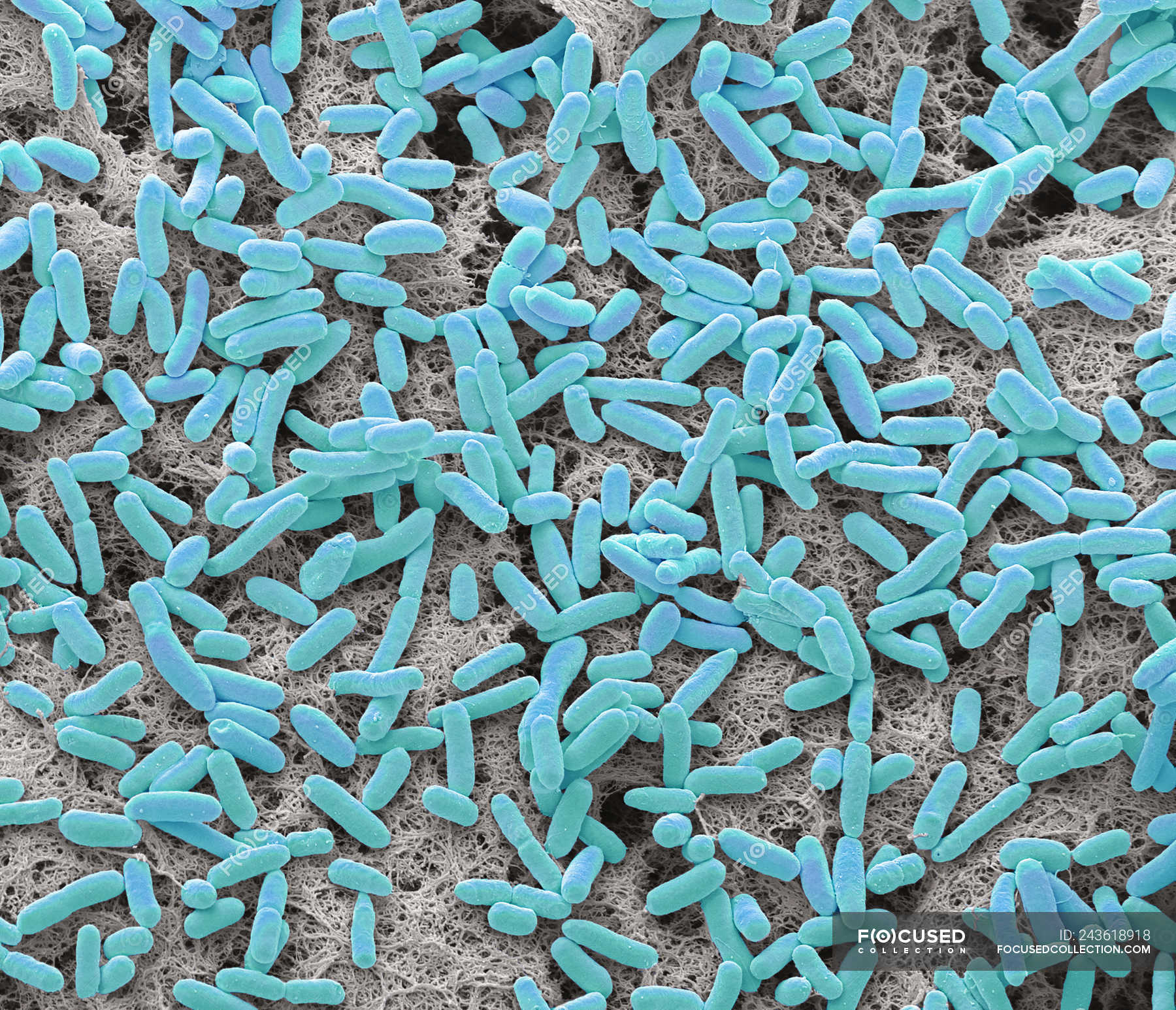 Colored Scanning Electron Micrograph Of Rod Shaped Gram Negative