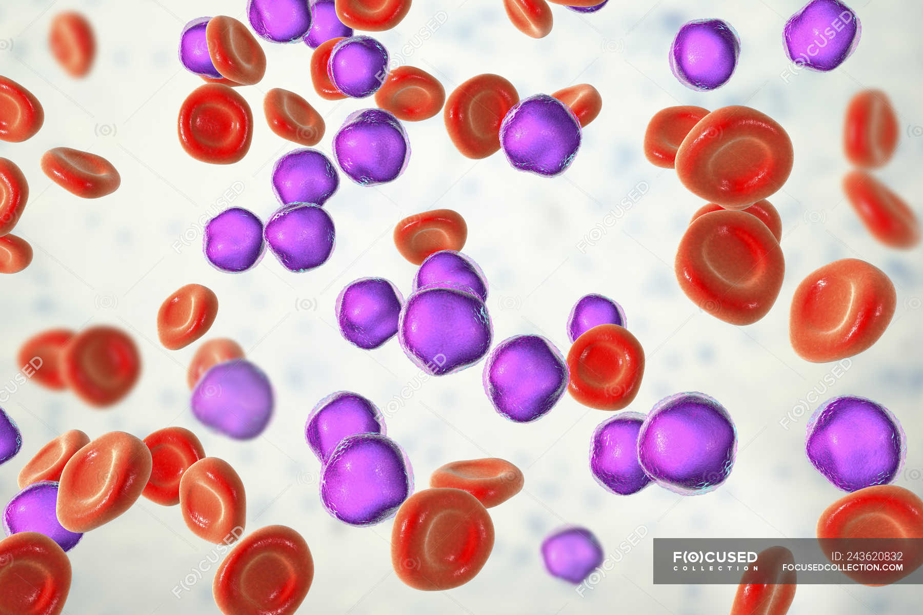 Colored Illustration Showing Abundant Lymphoblast Cells In Human Bone