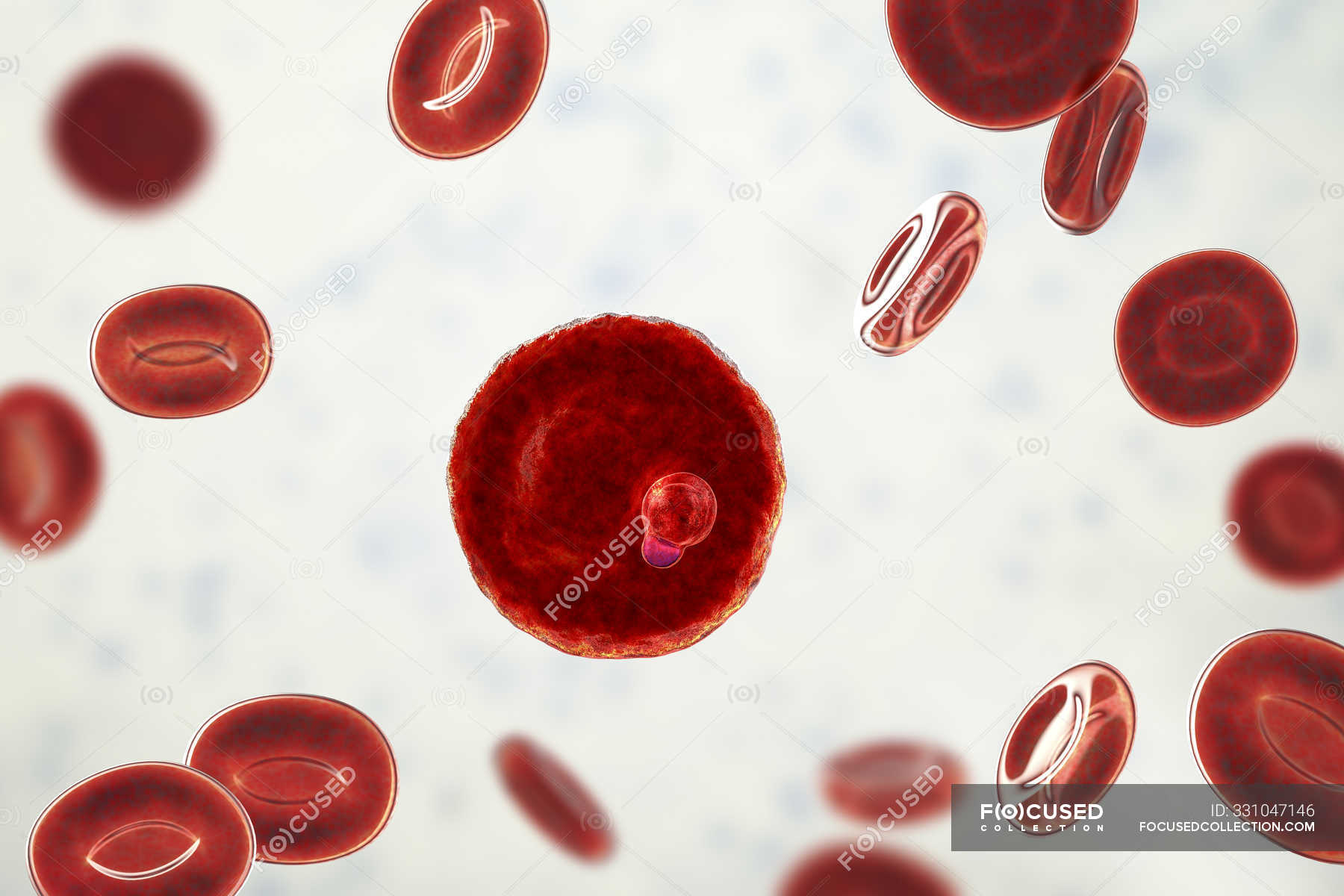 Plasmodium Malariae Protozoan And Red Blood Cells In Blood Vessel