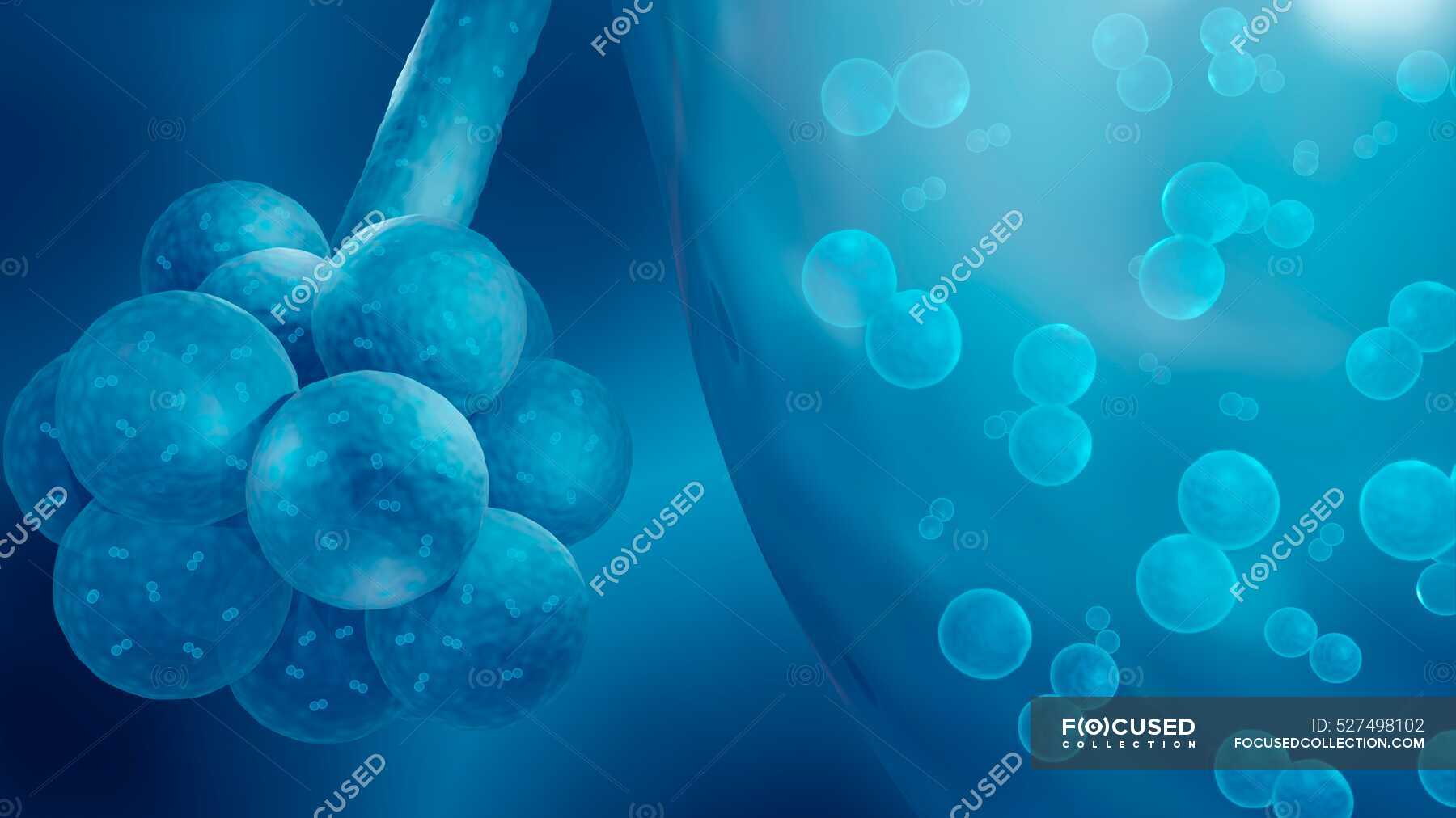 Streptococcus Pneumoniae Causing Bacterial Pneumonia In Alveoli