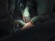 Cirujanos realizando cesárea - foto de stock