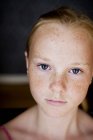 Close-up portrait of girl with freckles — Stock Photo