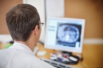 Médecin masculin regardant l'image radiogramme — Photo de stock