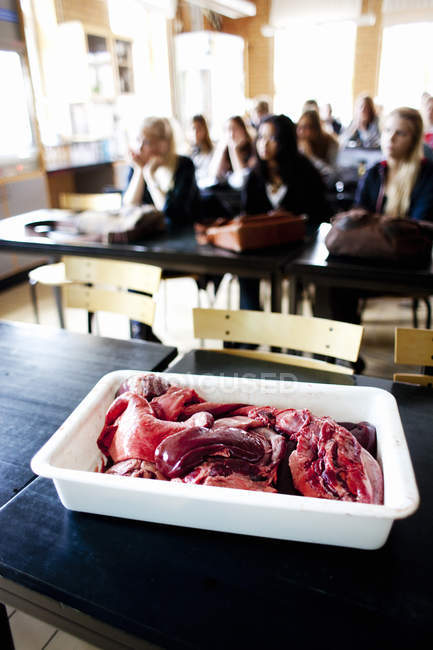 Людські органи в контейнері на столі — стокове фото