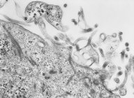 Сканирующий электронный микрограф вируса Эбола — стоковое фото