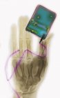 X-ray shoot of hand with personal mp3 player — Stock Photo