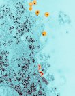 Сканирующий электронный микрограф вируса ВИЧ — стоковое фото