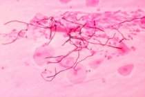 Micrographie électronique à balayage de candida albicans dans les tissus pulmonaires — Photo de stock