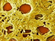 Бактерії Легіонелли з масштабованим правилом — стокове фото