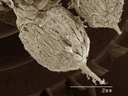 Micrografo elettronico a scansione colorata delle ovaie di cicala — Foto stock