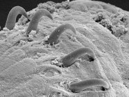 Micrographie électronique à balayage de ténia, 5000px — Photo de stock