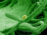 Sticky hair on Sundew leaf, Droscera sp SEM — Stock Photo