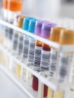 Rangée d'échantillons humains à analyser, y compris le sang, l'urine, la chimie, les protéines, les anticoagulants et le VIH — Photo de stock