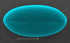 Micrografo elettronico a scansione che mostra il diatomo trovato in un campione di acqua non trattata estratta dal flusso selvatico — Foto stock