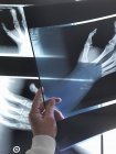 Doctor hand holding x-rays of hand in hospital — Stock Photo