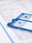 Blood samples on microscope slide sitting on results — Stock Photo