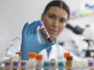 Лікар тримає аналіз крові в лабораторії для медичного тестування — стокове фото