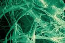 Micrografia eletrônica de varredura de amianto, 5000x — Fotografia de Stock