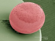 Кольорові мікрофотографія яйце шовкові молі — стокове фото