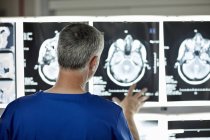 Вид ззаду чоловічий радіолог, який дивиться на сканування мозку — стокове фото