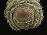 Coloured scanning electron micrograph of larva of human botfly — Stock Photo