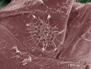 Micrografia eletrônica de varredura colorida de piolhos da casca tricobotria — Fotografia de Stock