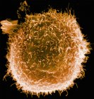 Micrografía electrónica de barrido de macrófagos humanos - foto de stock