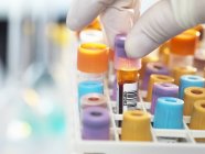 Labortechniker bereitet Blutprobe für medizinische Tests im Labor vor — Stockfoto