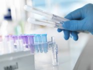 Cientista que prepara o esfregaço de ADN para análise num laboratório para testes forenses ou de paternidade — Fotografia de Stock