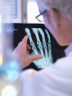 Radiographer looking at x-ray of hand fracture — Stock Photo