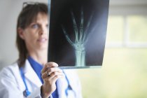 Doctor mirando la imagen de rayos X de la mano - foto de stock