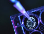 Исследования болезни Альцгеймера и слабоумия, сканирование мозга в многоколодезном подносе, используемом для научных экспериментов в лаборатории — стоковое фото