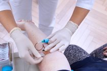 Ausgeschnittene Ansicht von Medizinern, die Bluttests durchführen — Stockfoto