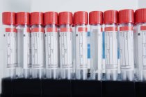 Test tubes in rows in dental laboratory — Stock Photo