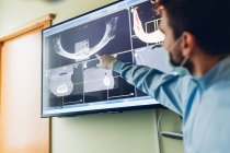 Zahnarzt betrachtet zahnärztliche Röntgenbilder, Fokus auf Hintergrund — Stockfoto
