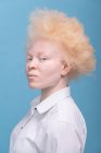 Retrato de estudio de mujer albina en camisa blanca - foto de stock