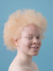 Portrait studio de femme souriante albinos — Photo de stock