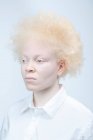 Estúdio retrato de mulher albina em camisa branca — Fotografia de Stock