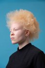 Portrait studio de femme albinos — Photo de stock