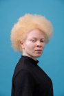 Studio ritratto di donna albina — Foto stock