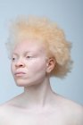 Portrait studio de femme albinos — Photo de stock