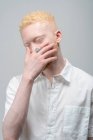 Studio portrait of albino man in white shirt — Stock Photo