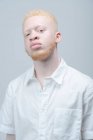Studioporträt eines Albino-Mannes im weißen Hemd — Stockfoto