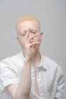Portrait studio de l'homme albinos en chemise blanche — Photo de stock