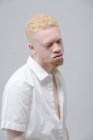 Studio ritratto dell'uomo albino in camicia bianca — Foto stock