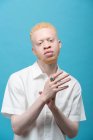 Estúdio retrato de albino homem em camisa branca — Fotografia de Stock