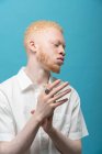 Studio portrait of albino man in white shirt — Stock Photo