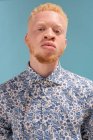 Studioporträt eines Albino-Mannes im blau gemusterten Hemd — Stockfoto